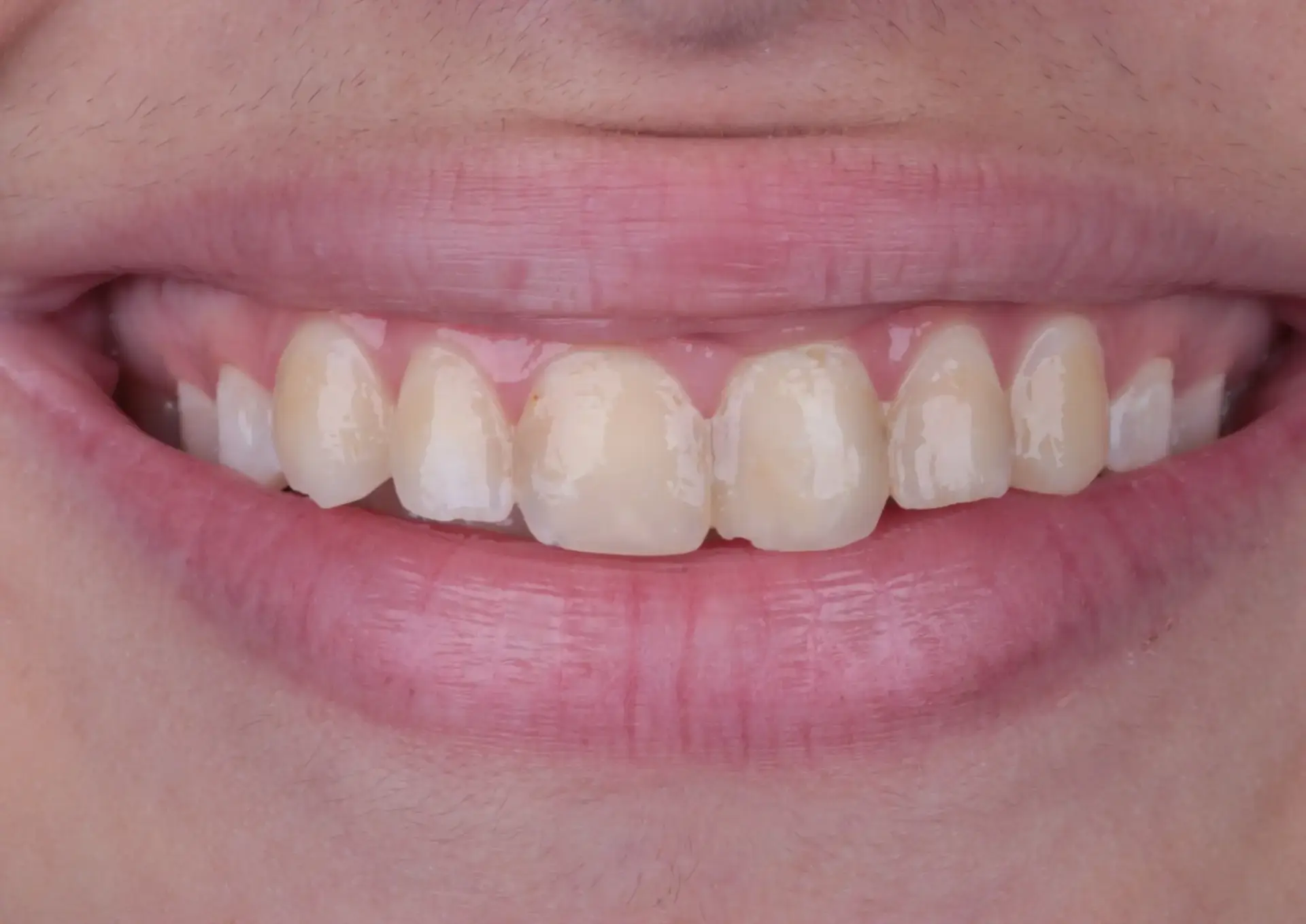 Picture 1 Natural veneers