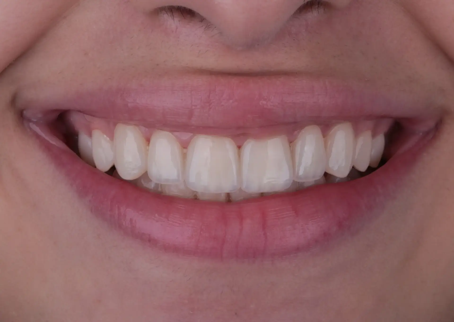 Picture 2 Natural veneers