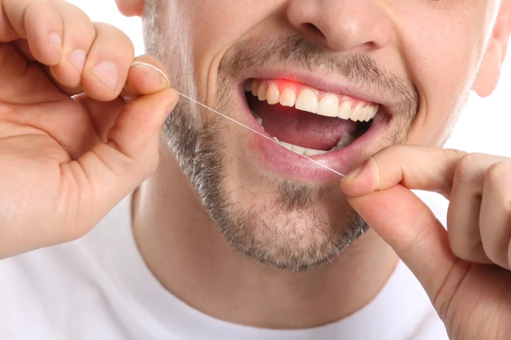 How to Care for Your Gums: The Key to Long-Term Oral Health